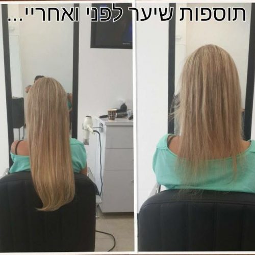 גלריית תוספות